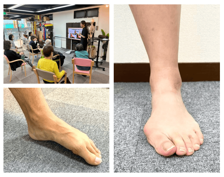 フットケアスペシャリストのための足爪専用抗菌ジェルが誕生